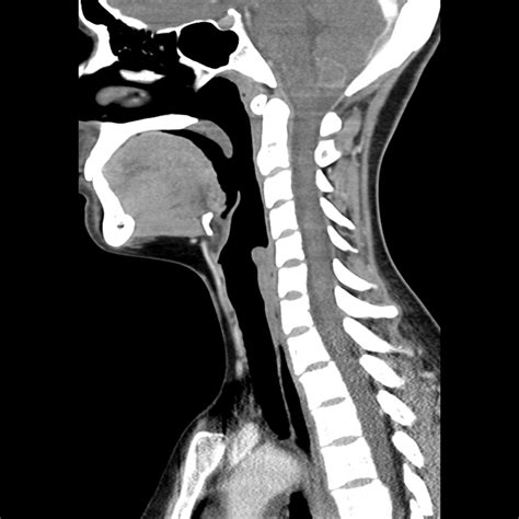 Ct Scan Neck Anatomy Car Tuning