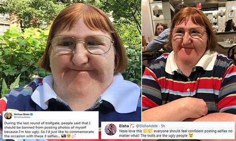 Blogger Told She Was Too Ugly For Selfies Posts Defiant Photos Daily Mail Online