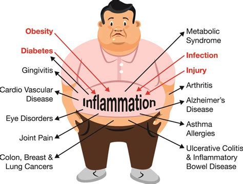 Inflammation Disease Begins In Your Gut Naked Biotics