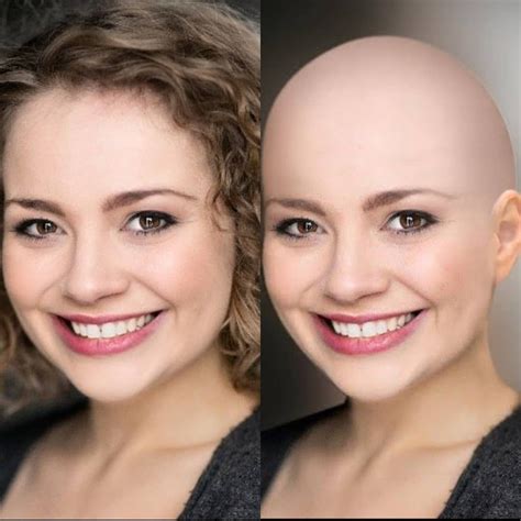 this is a before and after of carriehopefletcher before with her and after bald beautiful