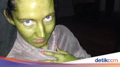 Maksud Hati Mau Tanning Wanita Ini Malah Berubah Kulitnya Jadi Hijau