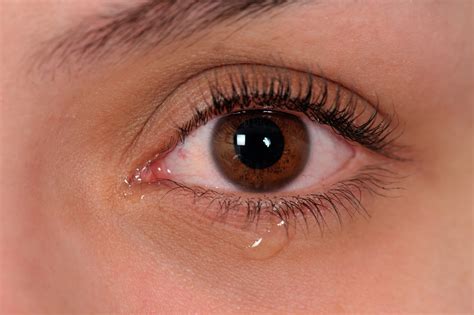 Blocked Tear Duct Infection
