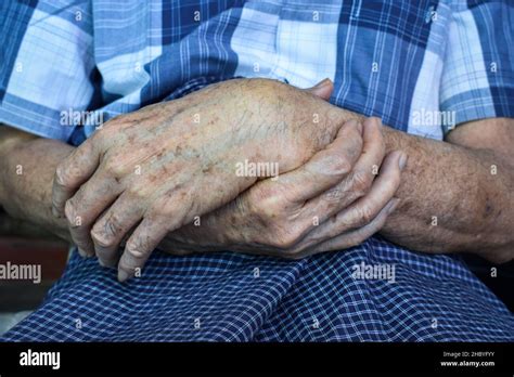 Age Spots On Hands Of Asian Elder Man They Are Brown Gray Or Black