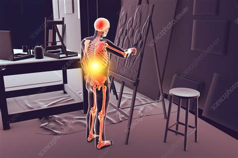 Artist With Back Pain Illustration Stock Image F0375311 Science