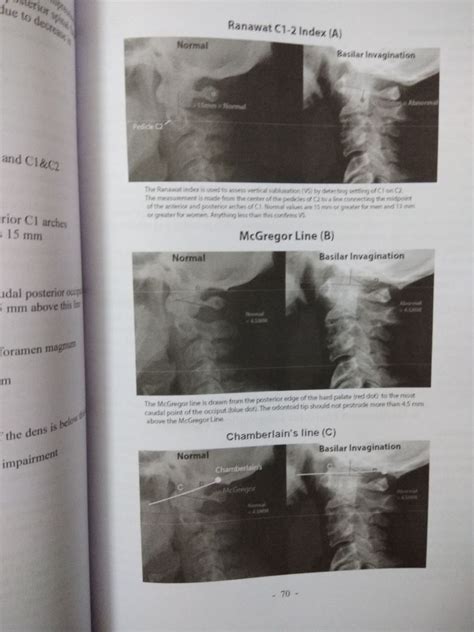 Dawangere Orthopaedic Notes Hard Copy 2018 Edition Dnb Orthopaedics