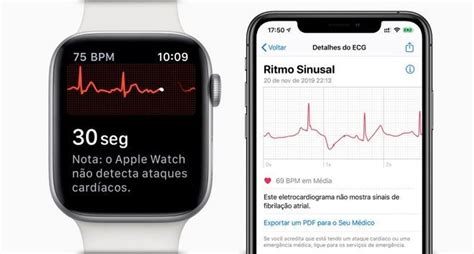 Once the instructions are followed, you will then be able to access. Apple Watch detecta doença melhor que eletrocardiograma ...