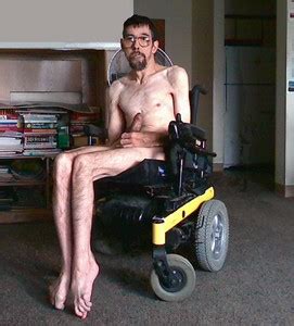 Naked Wheelchair Men Hot Sex Picture