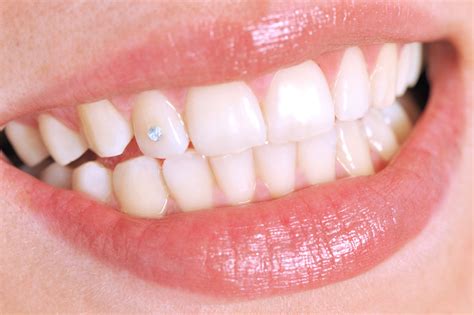 What Are Tooth Piercings And Are They Safe Espire Dental Wed Love