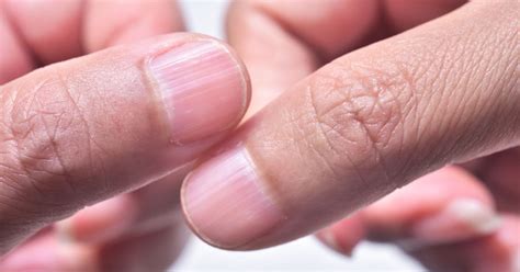 Sintetiza Más De 54 Imágenes Sobre Uñas Con Lineas Rectas Recién