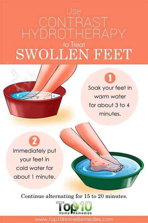 Top 10 Natural Home Remedies For Swollen Feet Foot Remedies