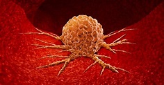 10 Types of Malignant Tumors - Facty Health