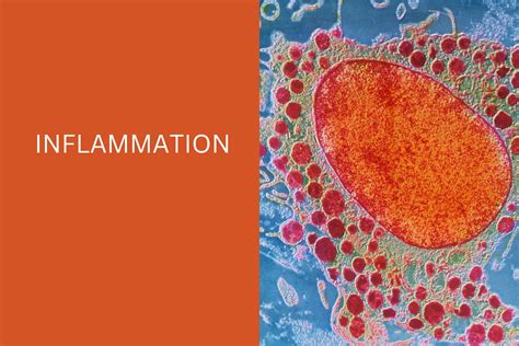 Inflammation Tragerology