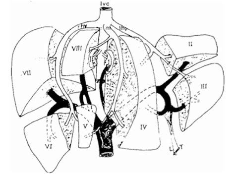 Schematic Overview Of Segmental Anatomy Of The Liver Commonly