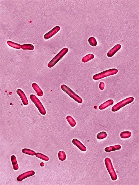 Pseudomonas Aeruginosa Bacteria Lm Stock Image C Science Photo Library