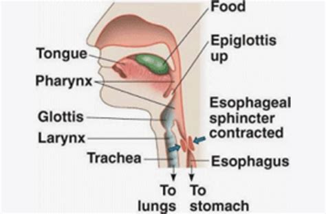 What causes a burning feeling in the chest after eating? Food Stuck In The Throat