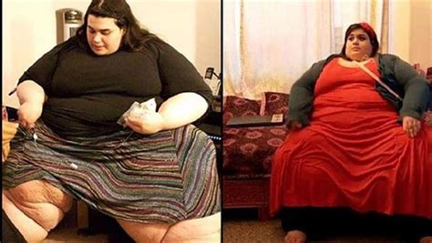 ‘super Obese’ Amber Loses An Astonishing 200kg