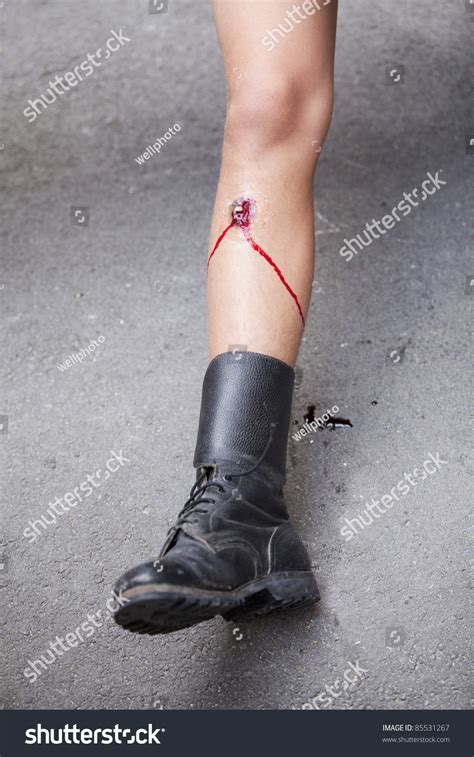 Gunshot Wound On Mens Leg Stock Photo 85531267 Shutterstock
