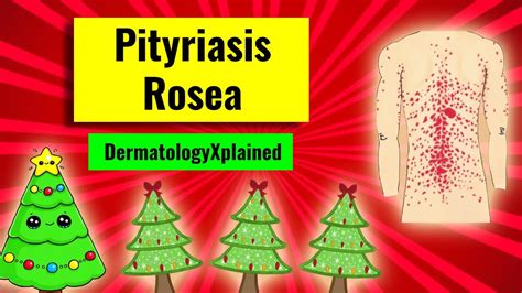 Pityriasis Rosea Christmas Tree Rash Clinical Features Associations
