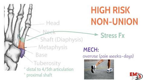 Emdocs Net Emergency Medicine Educationem In Th Metatarsal