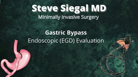 Gastric Bypass Endoscopy Egd Youtube