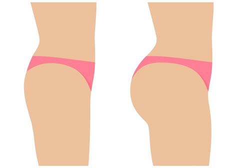 Why Is The Brazilian Butt Lift Such A Dangerous Procedure Boing Boing