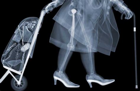 In Pictures Artist Nick Veasey Makes X Ray Vision Reality With These