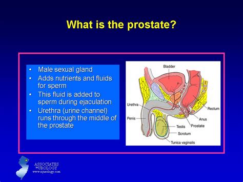 Sexual Life After Prostate Removal The Robotic Surgeon Home Of