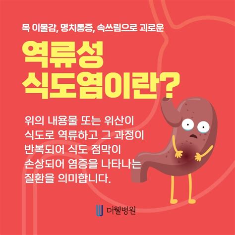 목이물감 속쓰림으로 괴로운 역류성 식도염 건강정보 수원 더웰병원