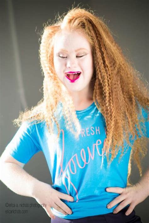 18 Year Old Model With Down Syndrome Will Walk At New York Fashion Week