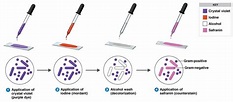 Gram Staining | Principle | Procedure and Results