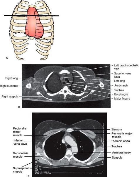 3 Chest Radiology Key