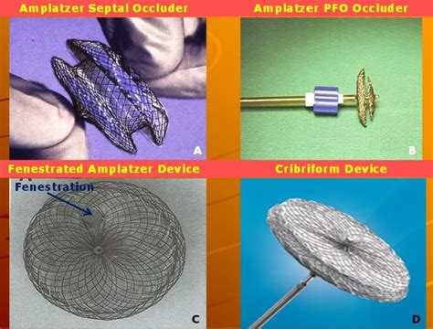 Photographs Of Amplatzer Septal Occluder Aso A Amplatzer Patent