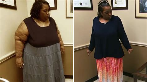 My 600 Lb Life June Mccamey Flaunts Weight Loss After Wedding