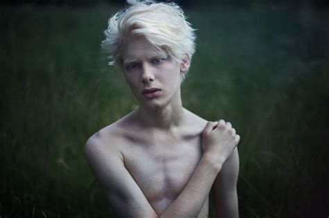 70 Best Images About Albinos On Pinterest Portrait Portrait