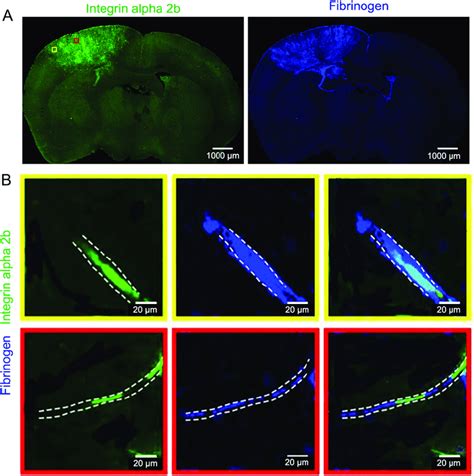 Representative Mouse Brain Slice Immunofluorescence Images After