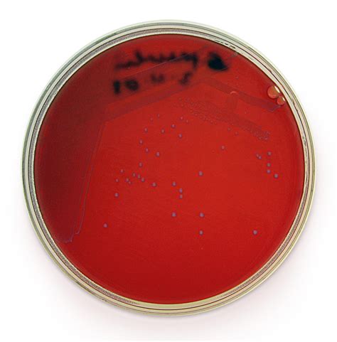 Listeria is known to veterinarians since the early 1900s all pathogenic strains of listeria (l. Cultivation Media for Bacteria
