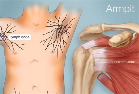 Image Result For Armpit Anatomy Armpit Lump Armpits Armpit Rash