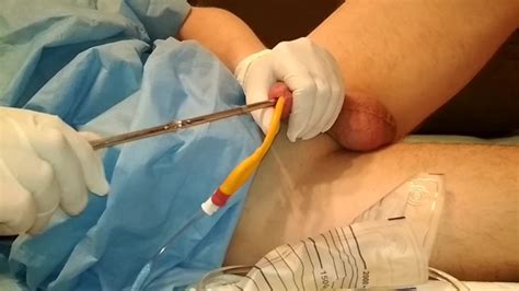 Insert 18fr Catheter And Small Sounding Play