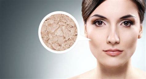 Dry Skin On Your Face Apply These 5 Moisturising Face Packs