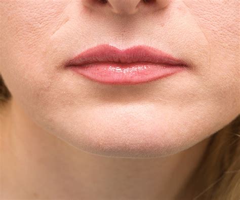 Everything You Need To Know About Lip Reduction The New Plastic Surgery Trend Shefinds