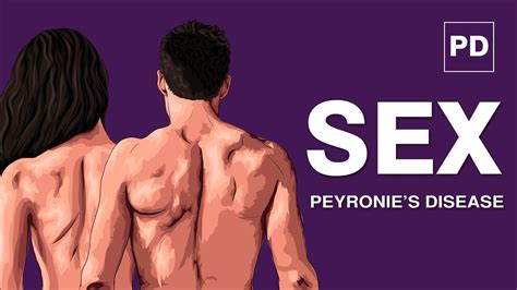 Peyronies Disease And Sex The Impact Of Pd On Your Sex Life Pd And