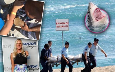 Exposed Top 10 Most Gruesome Shark Attacks — Savaged Organs Missing