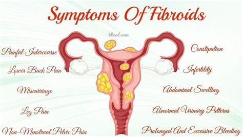 Uterine Fibroid Size Chart In Cm