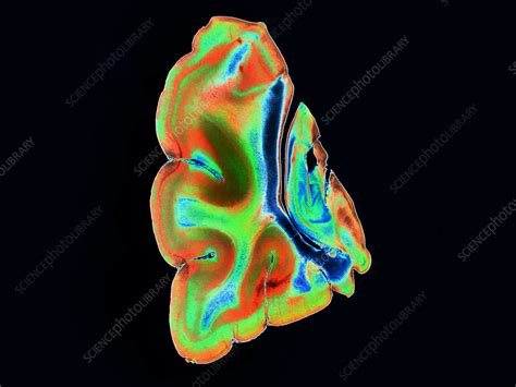 Cat Cerebrum Lm Stock Image C0093443 Science Photo Library