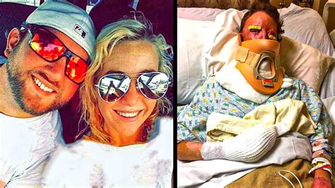 This Mom’s Husband Left After She Was Disfigured By A Campfire But Her Comeback Was