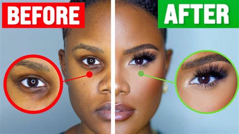 How To Cover Dark Under Eye Circles Youtube