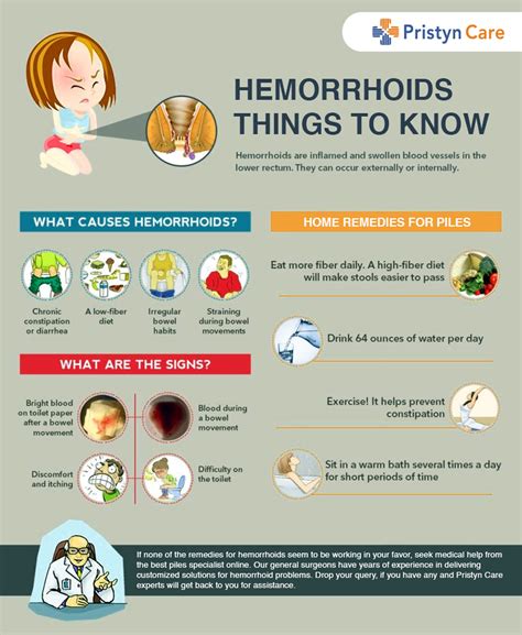 Is Hemorrhoid Painful Faqs Pristyn Care
