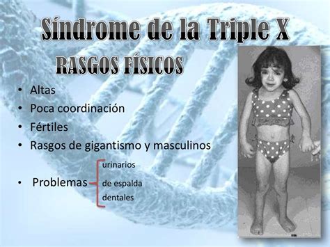 Síndrome de la triple x