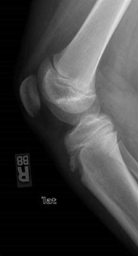 Line 4 X 6 Photo Printer - Liene 4x6 Instant Photo Printer (2022) Review