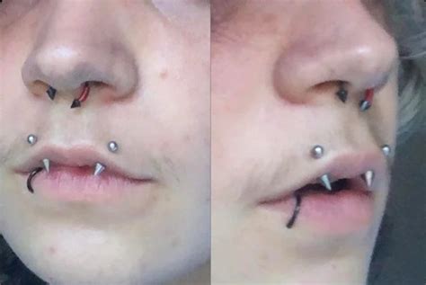 Unusual Lip Piercings